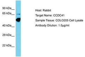 Image no. 1 for anti-Coiled-Coil Domain Containing 41 (CCDC41) (AA 148-197) antibody (ABIN6750609) (CCDC41 抗体  (AA 148-197))