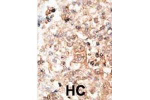 Immunohistochemistry (IHC) image for anti-Osteocalcin (BGLAP) antibody (ABIN3001265) (Osteocalcin 抗体)