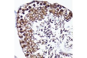 Immunohistochemistry of paraffin-embedded rat testis using PRMT5 antibody (ABIN7269605) at dilution of 1:100 (40x lens). (PRMT5 抗体)