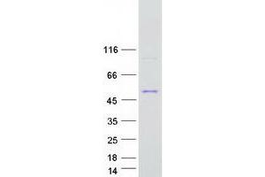Validation with Western Blot