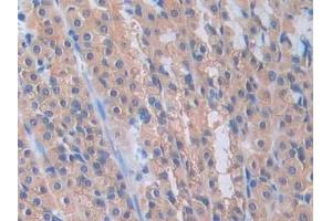 DAB staining on IHC-P; Samples: Rat Stomach Tissue (PANX1 抗体  (AA 77-260))