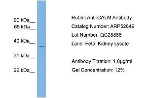 WB Suggested Anti-GALM  Antibody Titration: 0. (GALM 抗体  (Middle Region))