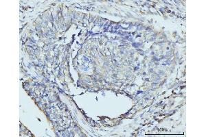 IHC analysis of RPL23 using anti-RPL23 antibody (ABIN7599808). (RPL23 抗体  (AA 12-136))