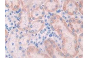 Detection of NCAD in Rat Kidney Tissue using Polyclonal Antibody to N-cadherin (NCAD) (N-Cadherin 抗体  (AA 295-414))