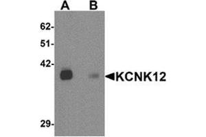 Western blot analysis of KCNK12 in rat brain tissue lysate with KCNK12 Cat. (KCNK12 抗体  (C-Term))