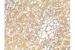 ABIN6262309 and ABIN6268941 at 1/100 staining Rat kidney tissue by IHC-P.