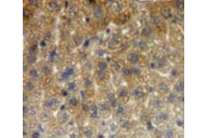 Used in DAB staining on fromalin fixed paraffin-embedded liver tissue (HSPE1 抗体  (AA 2-102))