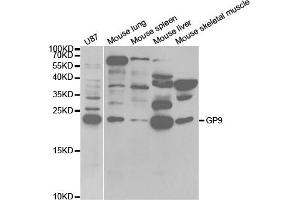 Western Blotting (WB) image for anti-Glycoprotein IX (Platelet) (GP9) antibody (ABIN1876562) (CD42a 抗体)