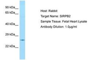 Image no. 1 for anti-Signal-Regulatory Protein beta 2 (SIRPb2) (AA 110-159) antibody (ABIN6750071) (SIRPb2 抗体  (AA 110-159))