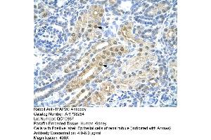 Immunohistochemistry (IHC) image for anti-Transcription Factor AP-2 gamma (Activating Enhancer Binding Protein 2 Gamma) (TFAP2C) (N-Term) antibody (ABIN2780497)