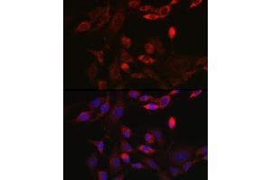 Immunofluorescence analysis of NIH/3T3 cells using BNIP3L Rabbit pAb (ABIN6129989, ABIN6137622, ABIN6137623 and ABIN6221881) at dilution of 1:100 (40x lens). (BNIP3L/NIX 抗体  (AA 1-187))