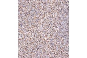 Immunohistochemistry (Paraffin-embedded Sections) (IHC (p)) image for anti-Interferon-Induced Transmembrane Protein 3 (IFITM3) (AA 1-30), (N-Term) antibody (ABIN387989)