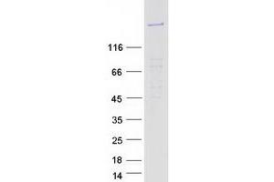 Western Blotting (WB) image for FERM and PDZ Domain Containing 4 (FRMPD4) protein (Myc-DYKDDDDK Tag) (ABIN2721421)