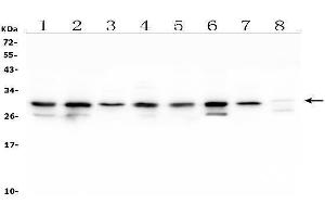 Western blot analysis of COMT using anti-COMT antibody (ABIN7601948).