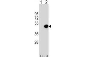 Western Blotting (WB) image for anti-Dynactin 2 (p50) (DCTN2) antibody (ABIN2997015) (Dynamitin 抗体)