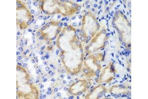 Immunohistochemistry of paraffin-embedded Mouse kidney using HCLS1 Polyclonal Antibody at dilution of 1:100 (40x lens). (HCLS1 抗体)