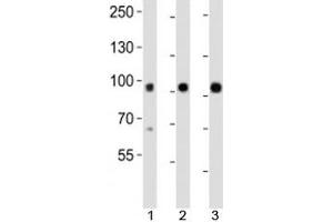 Western blot analysis of lysate from mouse 1) kidney, 2) lung and 3) skin tissue using Epha1 antibody at 1:1000. (EPHA1 抗体  (N-Term))