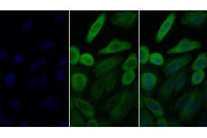 Detection of HSP90aA1 in Human HepG2 cell using Polyclonal Antibody to Heat Shock Protein 90 kDa Alpha A1 (HSP90aA1) (HSP90AA1 抗体  (AA 698-732))