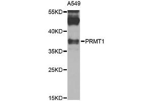Western blot analysis of extracts of A-549 cells, using PRMT1 antibody (ABIN1874325) at 1:1000 dilution. (PRMT1 抗体)