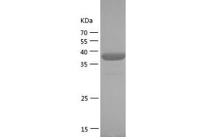 Western Blotting (WB) image for SUMO (AA 2-97) protein (GST tag) (ABIN7125241) (SUMO Protein (AA 2-97) (GST tag))