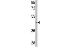 Western blot analysis of anti-SPHK1 Antibody (Center) in 293 cell line lysates (35 µg/lane). (SPHK1 抗体  (AA 286-315))