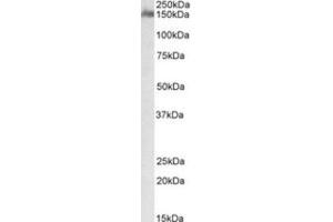 Western Blotting (WB) image for anti-CUB and Sushi Multiple Domains 1 (CSMD1) (Internal Region) antibody (ABIN2464386) (CSMD1 抗体  (Internal Region))