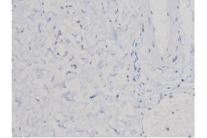ABIN6267463 at 1/200 staining Human esophagus tissue sections by IHC-P. (CDC25A 抗体  (pSer75))