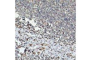 Immunohistochemical analysis of Beta-tubulin staining in human tonsil formalin fixed paraffin embedded tissue section. (TUBB 抗体)
