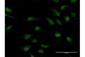 Immunofluorescence of purified MaxPab antibody to CRY1 on HeLa cell. (CRY1 抗体  (AA 1-586))