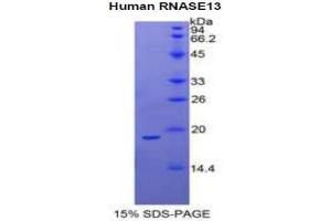 SDS-PAGE analysis of Human Ribonuclease A13 Protein. (RNASE13 蛋白)