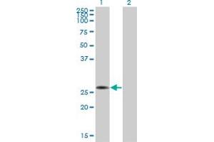 Western Blot analysis of CRSP9 expression in transfected 293T cell line by CRSP9 monoclonal antibody (M01), clone 3E7.
