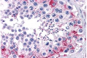 anti-Family with Sequence Similarity 175, Member A (FAM175A) (AA 1-313) antibody