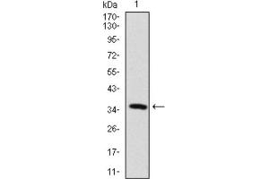 Western blot analysis using MAP2 antibody against human MAP2 recombinant protein. (MAP2 抗体  (AA 24-123))
