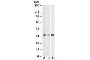 Western blot testing of human [A], mouse [B] and rat [C] brain lysate with EB3 antibody at 0. (MAPRE3 抗体)