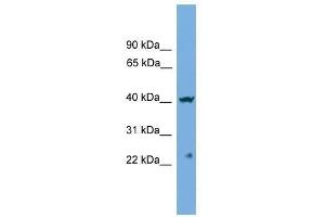 Western Blot showing CENPN antibody used at a concentration of 1-2 ug/ml to detect its target protein. (CENPN 抗体  (Middle Region))