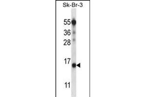 BTF3L4 Antibody (C-term) (ABIN657591 and ABIN2846592) western blot analysis in SK-BR-3 cell line lysates (35 μg/lane). (BTF3L4 抗体  (C-Term))