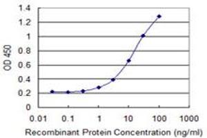 Detection limit for recombinant GST tagged RDH12 is 0. (RDH12 抗体  (AA 217-316))