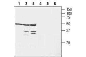 Western blot analysis of human SH-SY5Y neuroblastoma cell lysate (lanes 1 and 4), mouse brain lysate (lanes 2 and 5) and rat brain lysate (lanes 3 and 6): - 1-3.