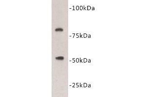 Western Blotting (WB) image for anti-Vitamin K-dependent protein C (PROC) antibody (ABIN1855001) (PROC 抗体)