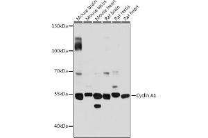 Western blot analysis of extracts of various cell lines, using Cyclin  antibody (4529) at 1:3000 dilution. (Cyclin A1 抗体  (AA 350-450))