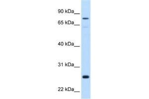 Western Blotting (WB) image for anti-Glutathione S-Transferase mu 2 (Muscle) (GSTM2) antibody (ABIN2462480) (GSTM2 抗体)