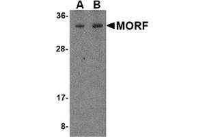 Western blot analysis of MORF4 in K562 cell lysate with MORF4 antibody at (A) 1 and (B) 2 μg/ml.