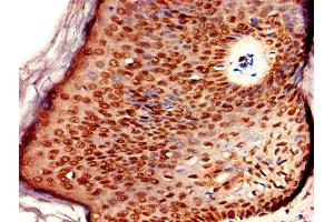 Immunohistochemistry of paraffin-embedded human skin tissue using ABIN7151618 at dilution of 1:100 (ERVK-6 抗体  (AA 90-632))