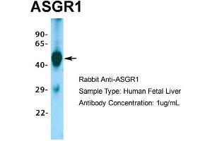 Host: Rabbit Target Name: ASGR1 Sample Type: Human Fetal Liver Antibody Dilution: 1. (Asialoglycoprotein Receptor 1 抗体  (Middle Region))