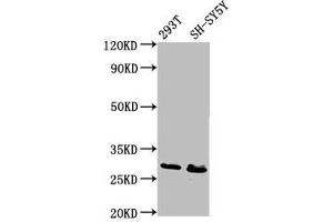 Western Blot Positive WB detected in: 293T whole cell lysate, SH-SY5Y whole cell lysate All lanes: RFXANK antibody at 6.