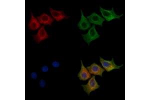 ABIN7094235 and ABIN7098282 staining HepG2 cells by IF/ICC. (Formin 2 抗体  (N-Term))