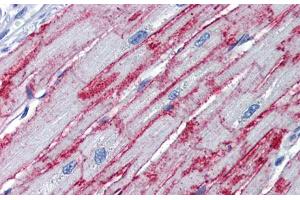 Immunohistochemistry with Human Heart lysate tissue at an antibody concentration of 5. (PNPT1 抗体  (Middle Region))