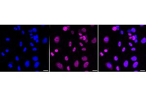 Immunocytochemical staining of Hela cells with CDCA51 antibody (ABIN7798019), 1:1,000). (Recombinant CDCA5 抗体)