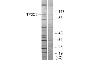 Western blot analysis of extracts from 293 cells, using TF3C3 antibody. (GTF3C3 抗体  (N-Term))