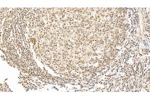 Immunohistochemistry (IHC) image for anti-Forkhead Box P3 (FOXP3) (AA 191-412) antibody (ABIN7426382)